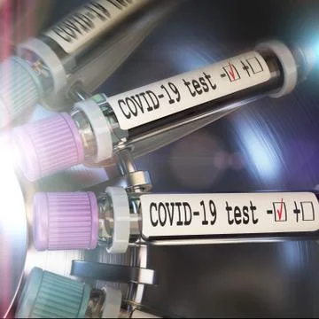 Negative COVID-19 test and laboratory sample of blood testing for diagnosis new Illustrazione stock
