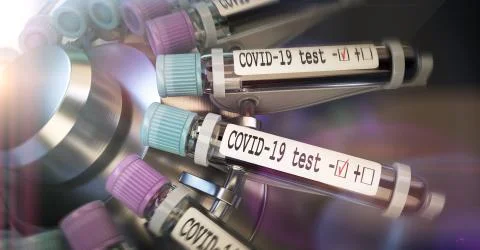 Negative COVID-19 test and laboratory sample of blood testing for diagnosis new Stock Illustration