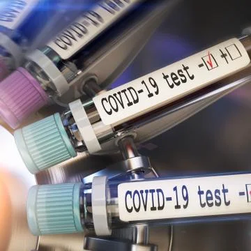 Negative COVID-19 test and laboratory sample of blood testing for diagnosis new Stock Illustration