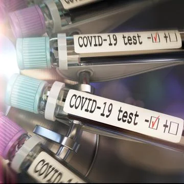 Negative COVID-19 test and laboratory sample of blood testing for diagnosis new 스톡 일러스트