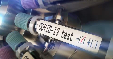 Negative COVID-19 test and laboratory sample of blood testing for diagnosis new 스톡 일러스트