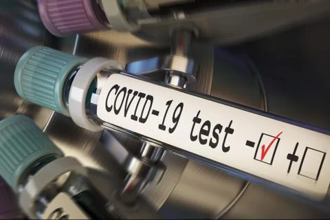 Negative COVID-19 test and laboratory sample of blood testing for diagnosis new Illustrazione stock