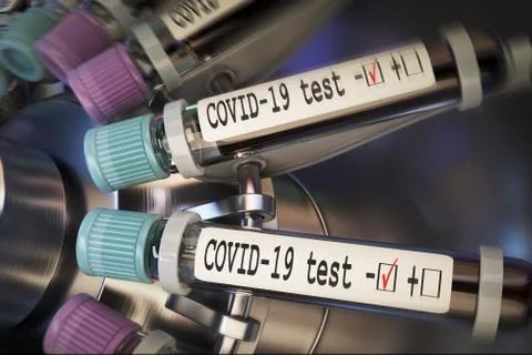 Negative COVID-19 test and laboratory sample of blood testing for diagnosis new 스톡 일러스트