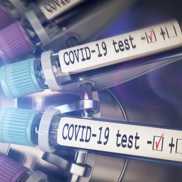 Negative COVID-19 test and laboratory sample of blood testing for diagnosis new Stock Illustration