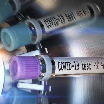 Negative COVID-19 test and laboratory sample of blood testing for diagnosis new Stock Illustration