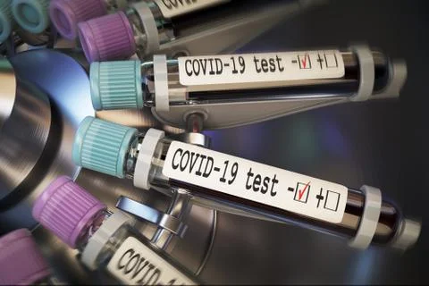 Negative COVID-19 test and laboratory sample of blood testing for diagnosis new Stock Illustration