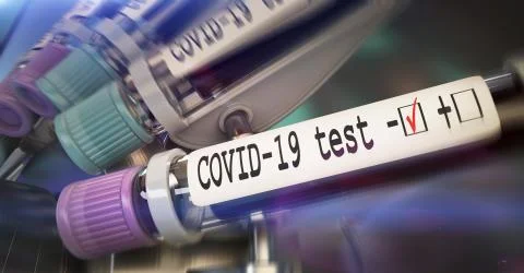 Negative COVID-19 test and laboratory sample of blood testing for diagnosis new Stock Illustration