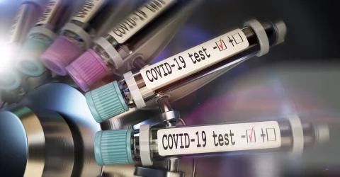 Negative COVID-19 test and laboratory sample of blood testing for diagnosis new 스톡 일러스트