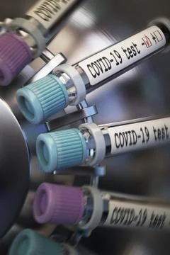 Negative COVID-19 test and laboratory sample of blood testing for diagnosis new Illustrazione stock