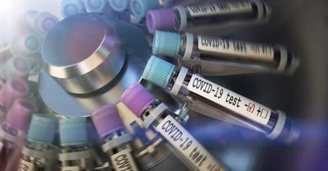 Negative COVID-19 test and laboratory sample of blood testing for diagnosis new Stock Illustration