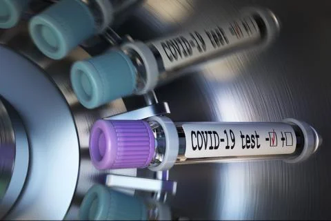 Negative COVID-19 test and laboratory sample of blood testing for diagnosis new Illustrazione stock