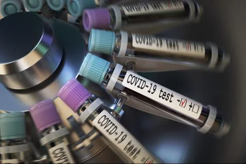 Negative COVID-19 test and laboratory sample of blood testing for diagnosis new Stock Illustration