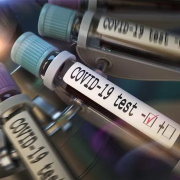 Negative COVID-19 test and laboratory sample of blood testing for diagnosis new Stock Illustration