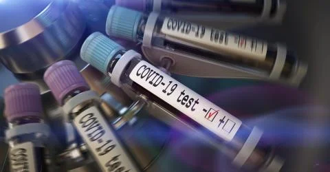 Negative COVID-19 test and laboratory sample of blood testing for diagnosis new Illustrazione stock