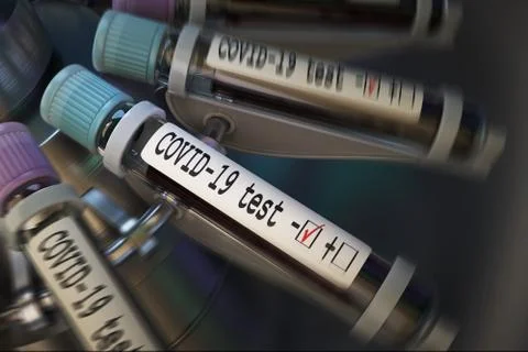 Negative COVID-19 test and laboratory sample of blood testing for diagnosis new Illustrazione stock