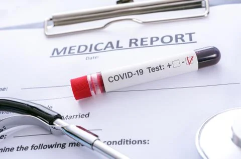 Negative COVID-19 test Stock Photos