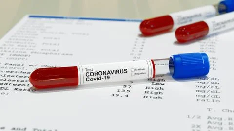 Negative or positive test result by using rapid test device for COVID-19, novel Stock Illustration