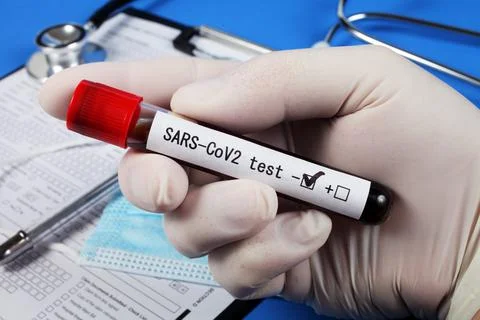 Negative Sars - CoV2 test , vacuum tube with blood in the doctor's hand Foto stock