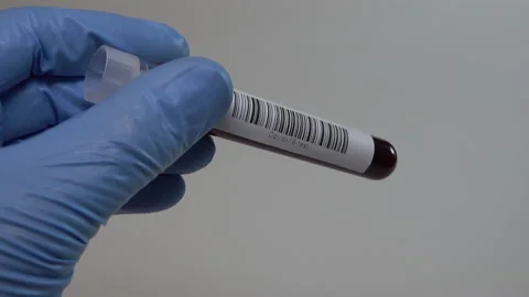 Negative test result Covid-19 coronavirus Stock Footage 130443276