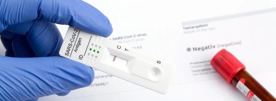 Negative test result by using rapid test device for COVID-19. Stock Photos