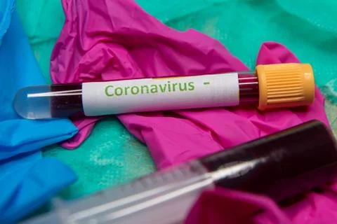 Negative testing at coronavirus Stock Photos