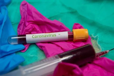 Negative testing at coronavirus Stock Photos
