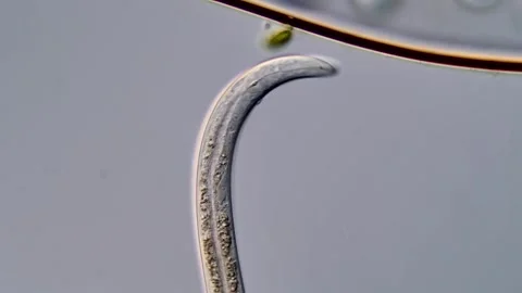 Nematoda larvae under microscope, 400x magnification 库存影片 310384311