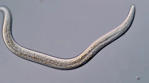Nematoda larvae under microscope 400x Vidéo 310386636