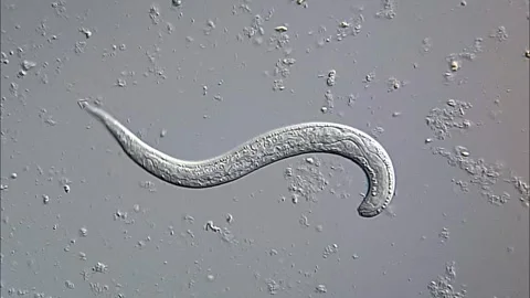 Nematoda Parasite in stool sample under microscopy 库存影片 306579752