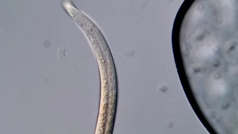 Nematoda under DIC microscope view 400x 库存影片 310356324