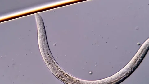 Nematoda under DIC microscope view, 400x magnification Vídeos de archivo 310357015