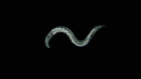 Nematoda worm under a microscope, is a parasite Video stock 105321059