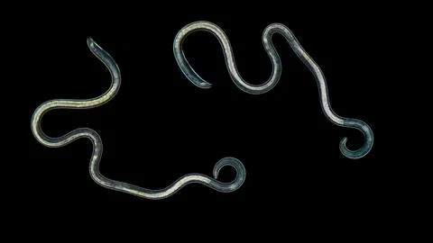 Nematoda worm under a microscope, type Protostomia. There are both parasitic  Photos