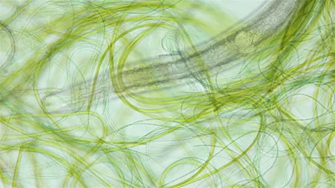 Nematoda worm under a microscope, worm movement among Cyanobacteria, widely Stock Footage 239429358