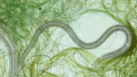Nematoda worm under a microscope, worm movement among Cyanobacteria, widely Stock Footage 239448307