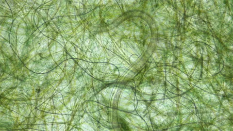 Nematoda worm under a microscope, worm movement among Cyanobacteria, widely Stock Footage 239448976