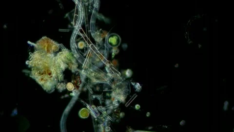 Nematode at 10x Under Darkfield Microscopy, Scientific Footage Stock Footage 336944228