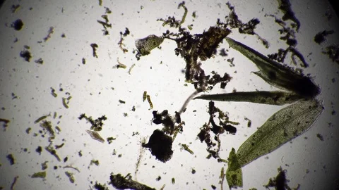 The nematode in algae feeds surrounded by a colony of infusoria Stock Footage 122263071