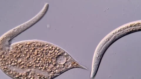 Nematode, Ciliophora dileptus under microscopy view 库存影片 310494666