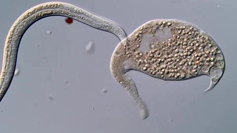 Nematode, dileptus Ciliate under microscopy view 库存影片 310490965