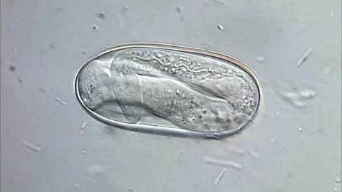 Nematode egg under microscopy view, 1000x 스톡 동영상 306577131