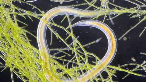 Nematode Stock Footage 64826714
