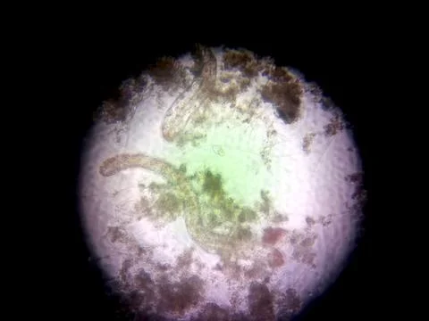 Nematode Germs Magnified Under Microscope Showing Structure and Habitat Detai Foto stock