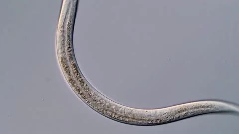 Nematode larvae under microscopy, pond water sample Vídeos de archivo 310496045