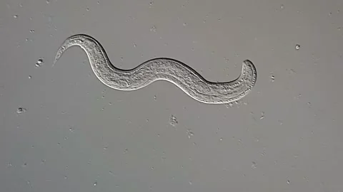 Nematode larvae under microscopy view, stool sample 库存影片 306574814