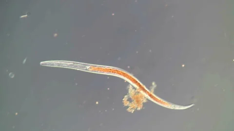 Nematode microscope view 스톡 동영상 68663370