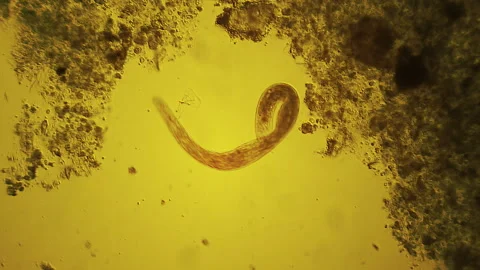 Nematode - microscopic worm Stock Footage 167325965