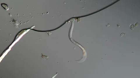 The nematode moves in the water droplet Stock Footage 338288595