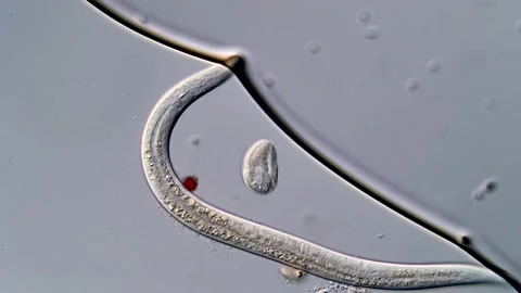 Nematode Parasite and Ciliate under microscopy view 400x 스톡 동영상 310501249