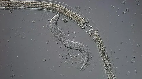 Nematode Parasite in feces under microscope view Vídeos de archivo 306572447